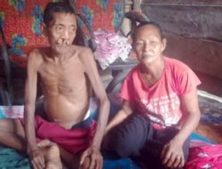 Warga Desa Kepala Siring Kec. Kikim Tengah Kab.Lahat Menderita Sakit Liver, Perut Membengkak, Minta Perhatian Bupati Lahat dan Dinkes