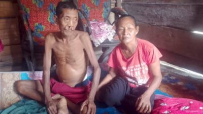 Warga Desa Kepala Siring Kec. Kikim Tengah Kab.Lahat Menderita Sakit Liver, Perut Membengkak, Minta Perhatian Bupati Lahat dan Dinkes